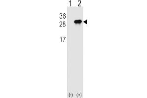 Western Blotting (WB) image for anti-Interleukin 28B (Interferon, lambda 3) (IL28B) antibody (ABIN2999039) (IL28B antibody)