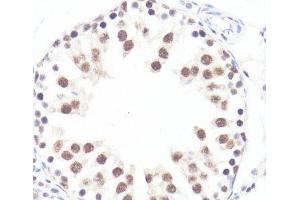 Immunohistochemistry of paraffin-embedded Rat testis using Phospho-MYC(S62) Polyclonal Antibody at dilution of 1:100 (40x lens). (c-MYC antibody  (pSer62))