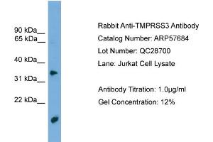 WB Suggested Anti-TMPRSS3  Antibody Titration: 0. (TMPRSS3 antibody  (N-Term))