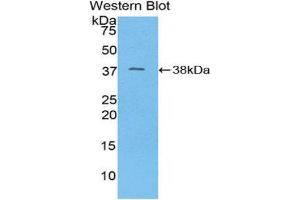 Western Blotting (WB) image for anti-Mitochondrially Encoded NADH Dehydrogenase 1 (MT-ND1) (AA 122-171) antibody (ABIN1859975) (MT-ND1 antibody  (AA 122-171))