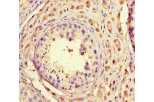 Immunohistochemistry of paraffin-embedded human testis tissue using ABIN7172681 at dilution of 1:100 (TAF2 antibody  (AA 400-450))