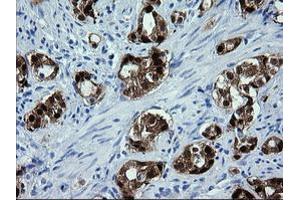 Image no. 1 for anti-Cytidine Monophosphate (UMP-CMP) Kinase 1, Cytosolic (CMPK1) antibody (ABIN1497545) (Cytidine Monophosphate (UMP-CMP) Kinase 1, Cytosolic (CMPK1) antibody)