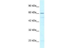 WB Suggested Anti-ZNF212 Antibody Titration:  0.