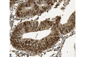 IHC analysis of FOXP1 using anti-FOXP1 antibody (ABIN7602780). (FOXP1 antibody  (C-Term))