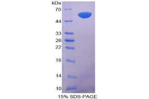 SDS-PAGE (SDS) image for Surfactant Protein A1 (SFTPA1) (AA 21-248) protein (His tag,GST tag) (ABIN2123626)