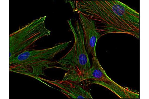 Clathrin Heavy Chain (CLTC) antibody