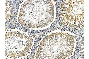 ABIN7095536 and ABIN7099593 at 1/100 staining rat testis tissue by IHC-P. (FBXO4 antibody)