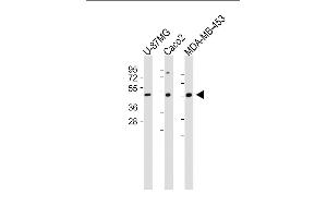 All lanes : Anti-KCNJ13 Antibody (N-term) at 1:1000 dilution Lane 1: U-87 MG whole cell lysate Lane 2: Caco2 whole cell lysate Lane 3: MDA-MB-453 whole cell lysate Lysates/proteins at 20 μg per lane.