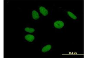 Immunofluorescence of purified MaxPab antibody to ZNF43 on HeLa cell. (ZNF43 antibody  (AA 1-803))