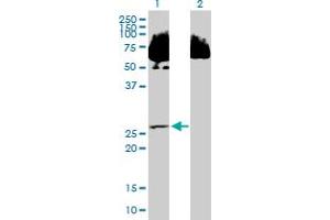 Western Blot analysis of SDR39U1 expression in transfected 293T cell line by SDR39U1 MaxPab polyclonal antibody. (SDR39U1 antibody  (AA 1-293))