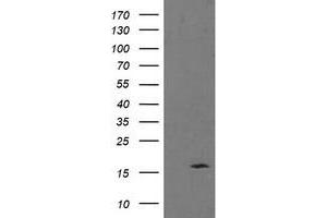 Western Blotting (WB) image for anti-Tumor Protein D52-Like 3 (TPD52L3) antibody (ABIN1501479) (TPD52L3 antibody)