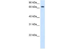 WB Suggested Anti-HAL Antibody Titration:  1.