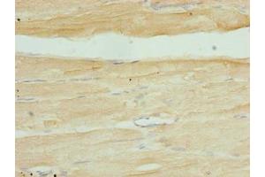 Immunohistochemistry of paraffin-embedded human skeletal muscle tissue using ABIN7169356 at dilution of 1:100 (SERTAD1 antibody  (AA 1-236))