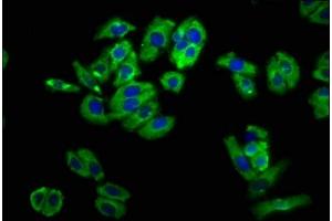 Immunofluorescence staining of HepG2 cells with ABIN7161183 at 1:100, counter-stained with DAPI. (UNC5B antibody  (AA 404-517))