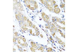 Immunohistochemistry of paraffin-embedded human gastric using DARS2 antibody at dilution of 1:100 (x40 lens). (DARS2 antibody)