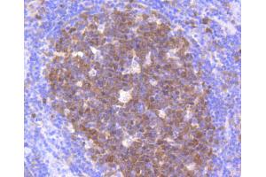 Immunohistochemistry (Paraffin-embedded Sections) (IHC (p)) image for anti-Cyclin-Dependent Kinase 2 (CDK2) antibody (ABIN5557541)