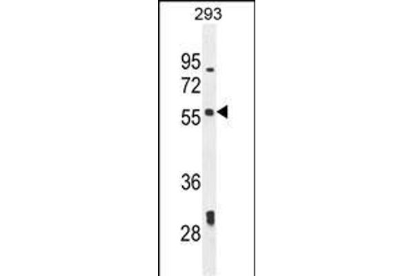 LARP6 Antikörper  (N-Term)