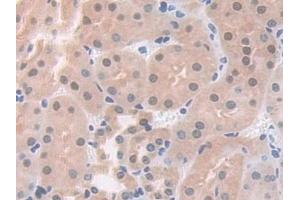 Detection of PDXK in Mouse Kidney Tissue using Polyclonal Antibody to Pyridoxal Kinase (PDXK)