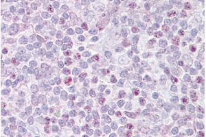 Immunohistochemistry with Thymus tissue at an antibody concentration of 5µg/ml using anti-EBF1 antibody (ARP39578_P050) (EBF1 antibody)