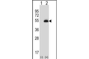 Western blot analysis of X6 (arrow) using rabbit polyclonal X6 Antibody (ABIN656844 and ABIN2846051). (PAX6 antibody)