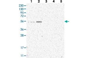 Western blot analysis of Lane 1: RT-4, Lane 2: U-251 MG, Lane 3: Human Plasma, Lane 4: Liver, Lane 5: Tonsil with IQCC polyclonal antibody  at 1:250-1:500 dilution. (IQCC antibody)