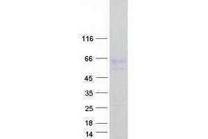 Validation with Western Blot (Nyctalopin Protein (NYX) (Myc-DYKDDDDK Tag))