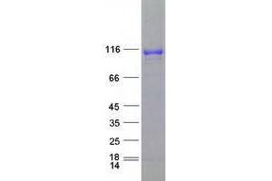 Validation with Western Blot (DPP6 Protein (Transcript Variant 1) (Myc-DYKDDDDK Tag))