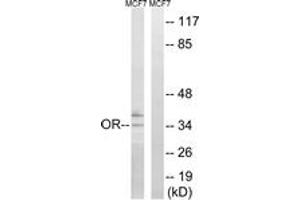 Western blot analysis of extracts from MCF-7 cells, using OR51H1 Antibody. (OR51H1 antibody  (AA 201-250))