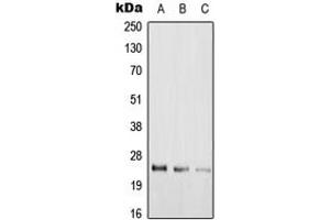 Western blot analysis of RAB39A expression in Hela (A), rat lung (B), H9C2 (C) whole cell lysates. (RAB39A antibody  (Center))
