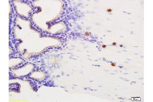 Formalin-fixed and paraffin embedded rat seminal vesicle labeled with Anti-Phospho-Dab1 (Tyr232) Polyclonal Antibody, Unconjugated (ABIN684343) at 1:200 followed by conjugation to the secondary antibody and DAB staining. (DAB1 antibody  (pTyr232))