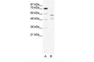 Image no. 1 for anti-Tripartite Motif Containing 23 (TRIM23) (C-Term) antibody (ABIN203204) (TRIM23 antibody  (C-Term))