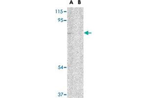 Western blot analysis of UIMC1 in 293 cell lysate in (A) the absence and (B) presence of blocking peptide with UIMC1 polyclonal antibody  at 1 ug/mL .