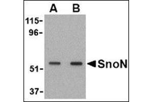 Western blot analysis of SnoN in A431 cell lysate with this product at (A) 0. (SKIL antibody  (N-Term))