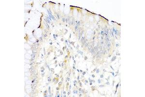 Immunohistochemistry of paraffin-embedded human colon using NRG4 antibody at dilution of 1:100 (40x lens). (Neuregulin 4 antibody)