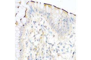 Immunohistochemistry of paraffin-embedded human colon using NRG4 antibody at dilution of 1:100 (40x lens).