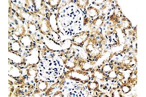 Formalin-fixed and paraffin embedded mouse kidney labeled with Anti-MCP-2 Polyclonal Antibody, Unconjugated (ABIN676283) at 1:200 followed by conjugation to the secondary antibody and DAB staining (CCL8 antibody  (AA 24-99))
