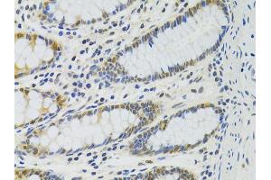 Immunohistochemistry of paraffin-embedded human colon using PPP4C antibody (ABIN5971135) at dilution of 1/100 (40x lens). (PPP4C antibody)
