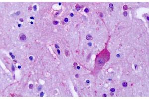 Anti-MGLUR4 antibody IHC staining of human brain, cortex, neurons.