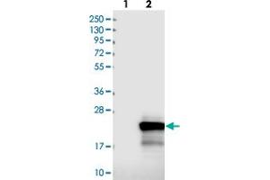 Western blot analysis of Lane 1: Negative control (vector only transfected HEK293T lysate), Lane 2: Over-expression Lysate (Co-expressed with a C-terminal myc-DDK tag (~3. (TPPP2 antibody)