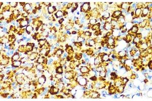 Immunohistochemistry of paraffin-embedded Rat ovary using PBEF / NAMPT Polyclonal Antibody at dilution of 1:100 (40x lens). (NAMPT antibody)
