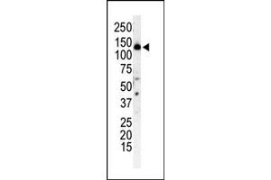 Western Blotting (WB) image for anti-Phosphoinositide 3-kinase Regulatory Subunit 4 (PIK3R4) (N-Term) antibody (ABIN360462) (PIK3R4 antibody  (N-Term))