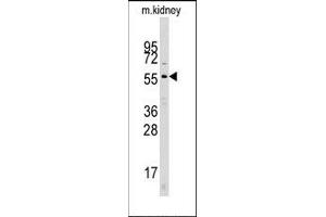 Image no. 1 for anti-Cell Division Cycle 25 Homolog A (S. Pombe) (CDC25A) (N-Term) antibody (ABIN358770) (CDC25A antibody  (N-Term))