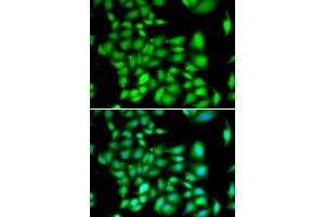 Immunofluorescence analysis of A549 cells using TREX1 antibody (ABIN5974106). (TREX1 antibody)