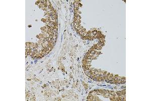 Immunohistochemistry of paraffin-embedded human prostate using CD62P/P-selectin antibody (ABIN6131514, ABIN6147503, ABIN6147506 and ABIN6218519) at dilution of 1:100 (40x lens).