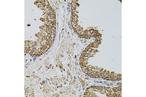 Immunohistochemistry of paraffin-embedded human prostate using CD62P/P-selectin antibody (ABIN6131514, ABIN6147503, ABIN6147506 and ABIN6218519) at dilution of 1:100 (40x lens). (P-Selectin antibody  (AA 30-200))