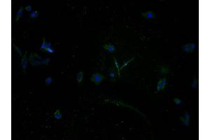 Immunofluorescence staining of HepG2 cells with ABIN7140161 at 1:100, counter-stained with DAPI. (TAS2R5 antibody  (AA 149-164))