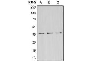 Western blot analysis of ZDHHC9 expression in HeLa (A), mouse kidney (B), rat brain (C) whole cell lysates.