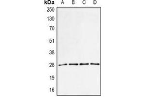 Western blot analysis of PA28 alpha expression in MCF7 (A), BT474 (B), mouse spleen (C), mouse liver (D) whole cell lysates.