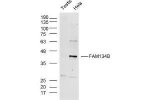 Lane 1: Mouse testis lysates, Lane 2: Hela lysates probed with FAM134B Polyclonal Antibody, Unconjugated  at 1:300 overnight at 4˚C. (FAM134B antibody  (AA 210-310))