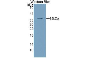 Detection of Recombinant ISR, Mouse using Polyclonal Antibody to Insulin Receptor (INSR) (Insulin Receptor antibody  (AA 1101-1372))